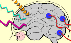 eeg neurofeedback boston